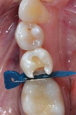 1605degoo P02 1605degoo P02