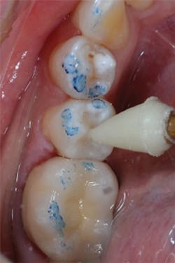 1605degoo P08 1605degoo P08