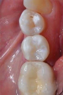 1605degoo P09 1605degoo P09