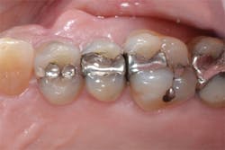 1605degoo P11 1605degoo P11