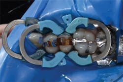 1605degoo P12 1605degoo P12