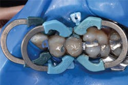 1605degoo P13 1605degoo P13