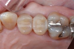 1605degoo P14 1605degoo P14