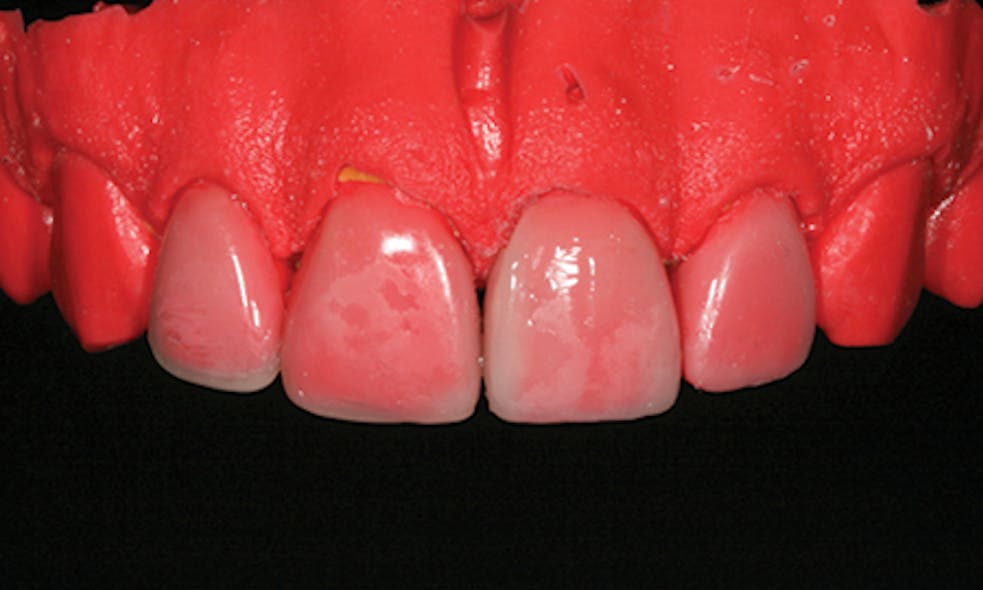 1605demau P06
