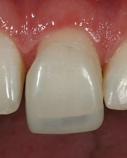 1605demau P11 1605demau P11