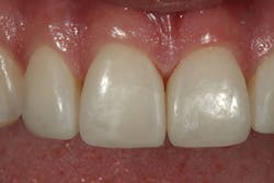 1605demau P20 1605demau P20