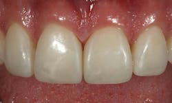 1605demau P22 1605demau P22