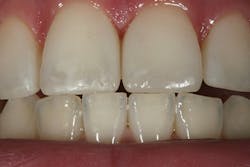 1605demau P25 1605demau P25