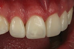 1605demau P28 1605demau P28