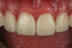 1605demau P30 1605demau P30