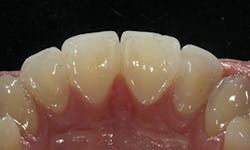 1605demau P31 1605demau P31