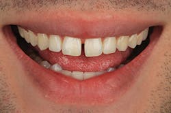 1605demau P32 1605demau P32