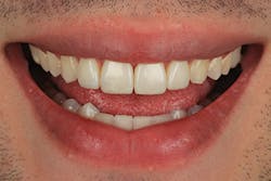 1605demau P33 1605demau P33