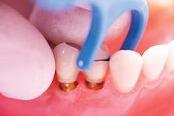 1605depea P04 1605depea P04