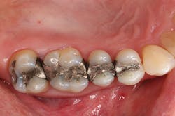 1606deses P01 1606deses P01