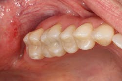 1606deses P05 1606deses P05