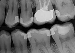 1607deoli P01 1607deoli P01