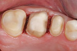 1607deoli P03 1607deoli P03