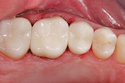 1607deoli P04 1607deoli P04