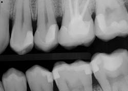 1607deoli P05 1607deoli P05