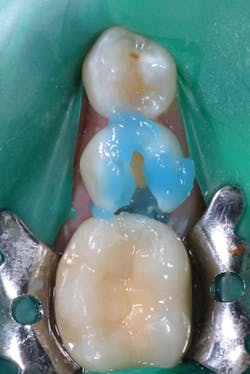 1609degoo P02 1609degoo P02