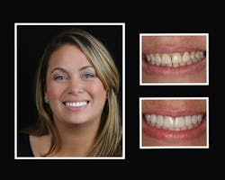 1609delot P02 1609delot P02