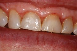 1609dewei P01 1609dewei P01