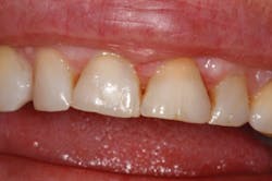 1609dewei P03 1609dewei P03