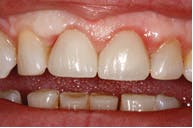 1609dewei P05 1609dewei P05