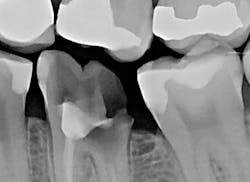 1609dewei P06 1609dewei P06