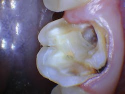 1609dewei P07 1609dewei P07