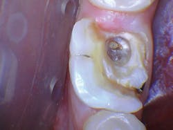 1609dewei P08 1609dewei P08