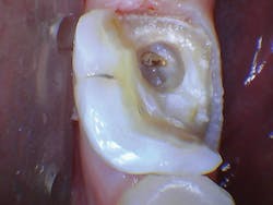 1609dewei P10 1609dewei P10