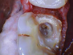 1609dewei P11 1609dewei P11