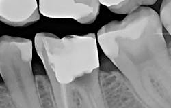 1609dewei P12 1609dewei P12