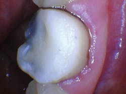 1609dewei P13 1609dewei P13