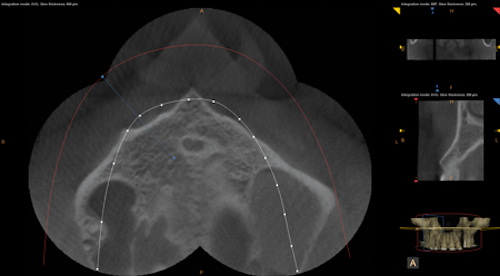 Screenshot Carestream