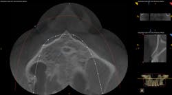 Screenshot Carestream Screenshot Carestream