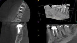 1610dechi P01 1610dechi P01