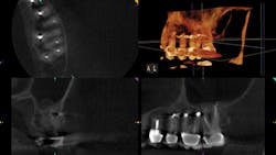 1610dechi P03 1610dechi P03