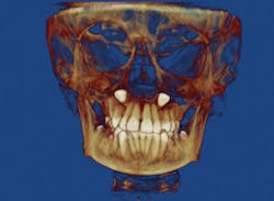 1610decur P02 1610decur P02