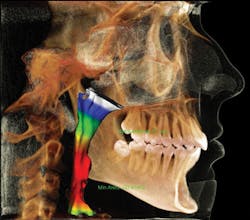 1610decur P03 1610decur P03