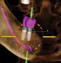 1610decur P04 1610decur P04