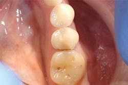 1610degoo P01 1610degoo P01