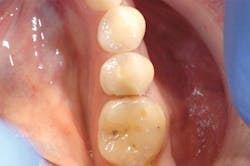 1610degoo P01 1610degoo P01