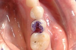 1610degoo P02 1610degoo P02