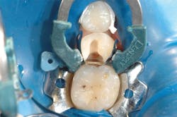 1610degoo P03 1610degoo P03