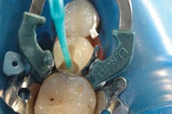 1610degoo P04 1610degoo P04