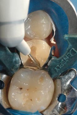 1610degoo P05 1610degoo P05