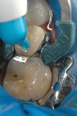 1610degoo P06 1610degoo P06